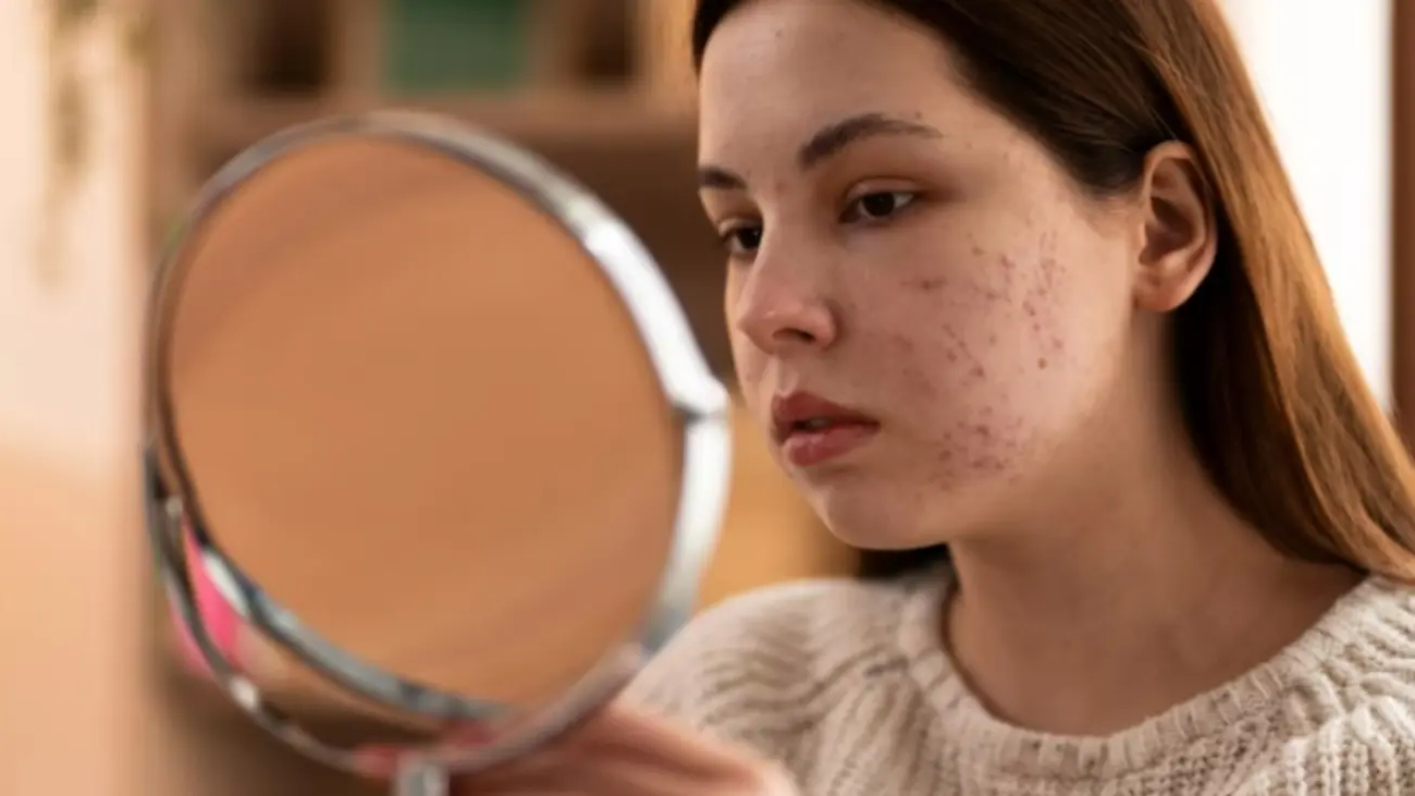 Tips to Remove Dark Spots from the Face.